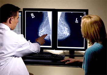 Mamografía Digital Pura: Ventajas para los pacientes